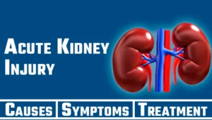 Acute Kidney Injury – Causes, Symptoms & Treatment