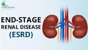 End-stage renal failure (ESRD)