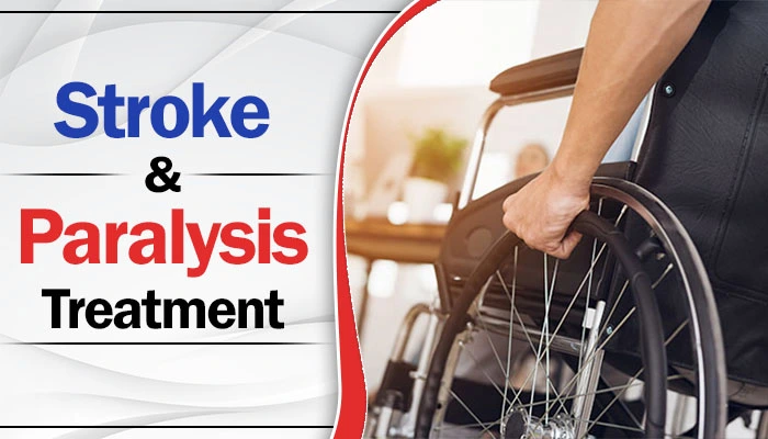 Stroke and Paralysis Treatment