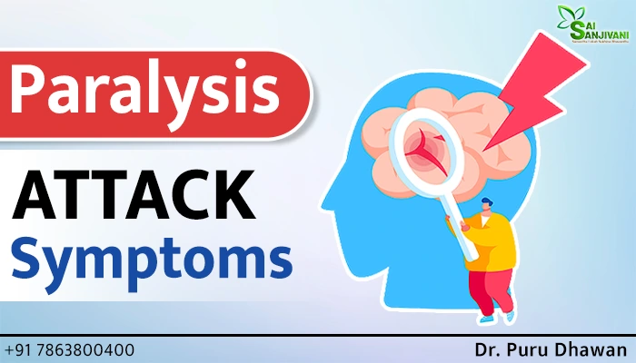 Paralysis Attack Symptoms